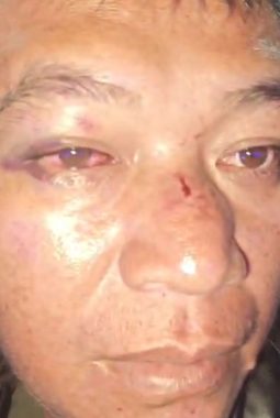 Harri Anson Tampubolon Allegedly Abused by Indonesian Army Officer, Case Reported to Military Police
